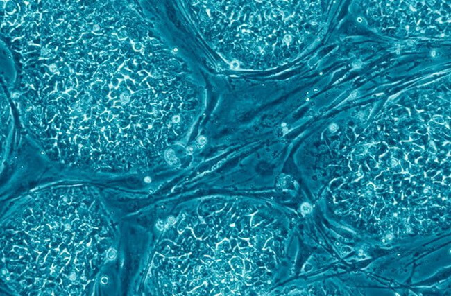 Перепрограмування стовбурових клітин